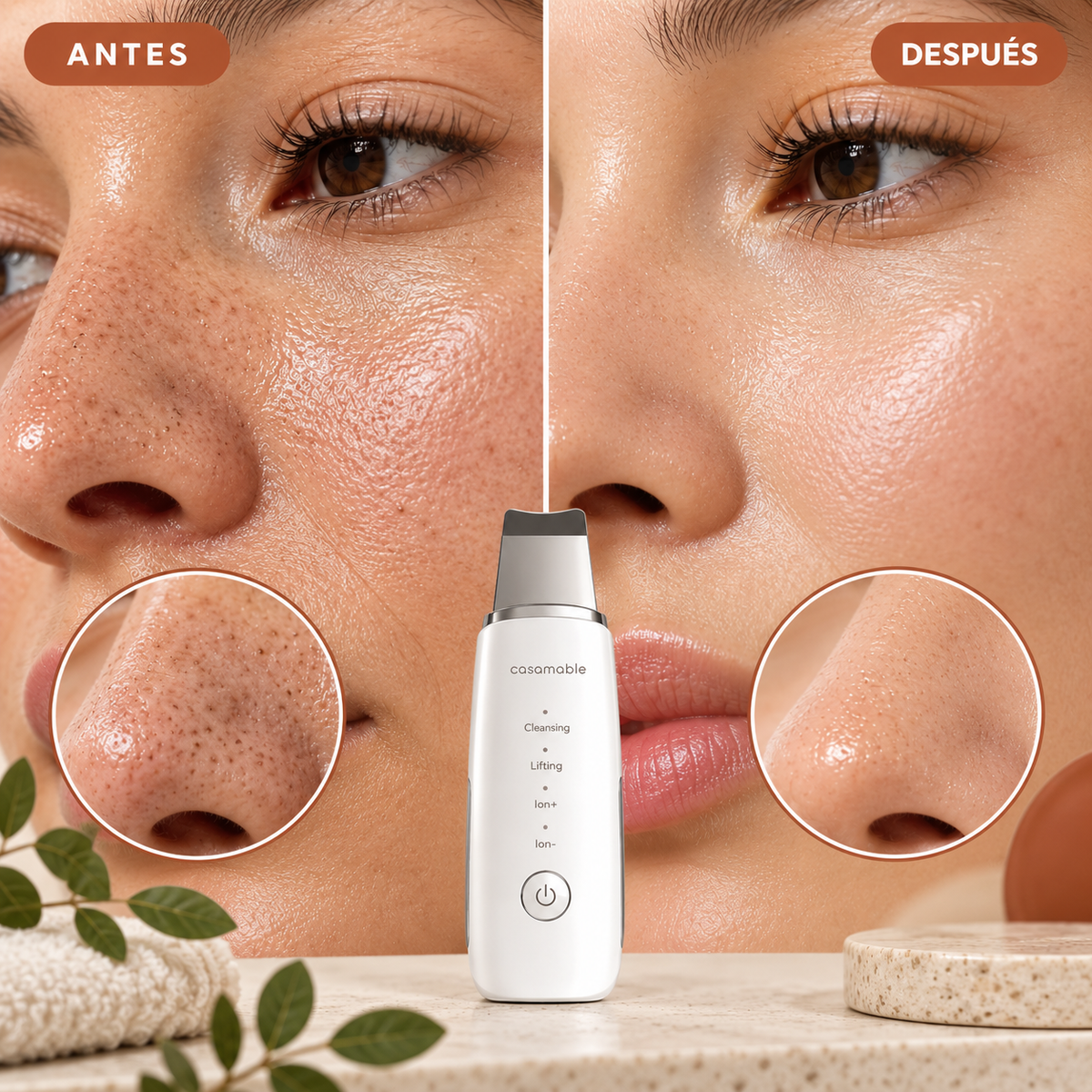 Limpiador Facial Ultrasónico Casamable™ – Limpieza Profunda en segundos